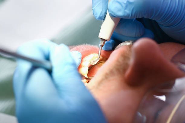 Best Emergency Treatment for Toothache in Rye Brook, NY